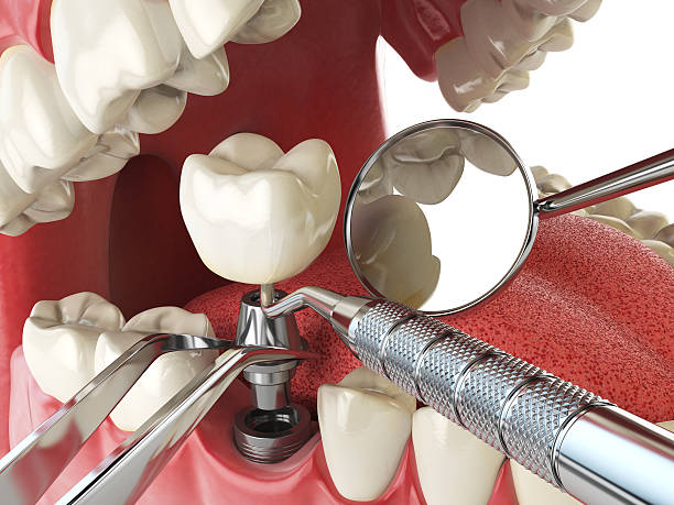 Best Cosmetic Emergency Dentistry in Indian Harbour Beach, FL